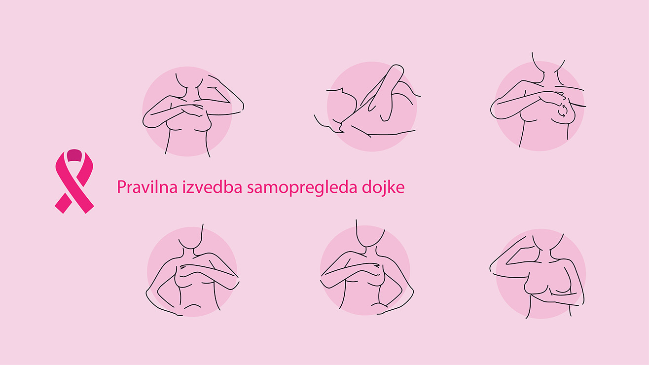 Pravilna izvedba samopregleda dojke